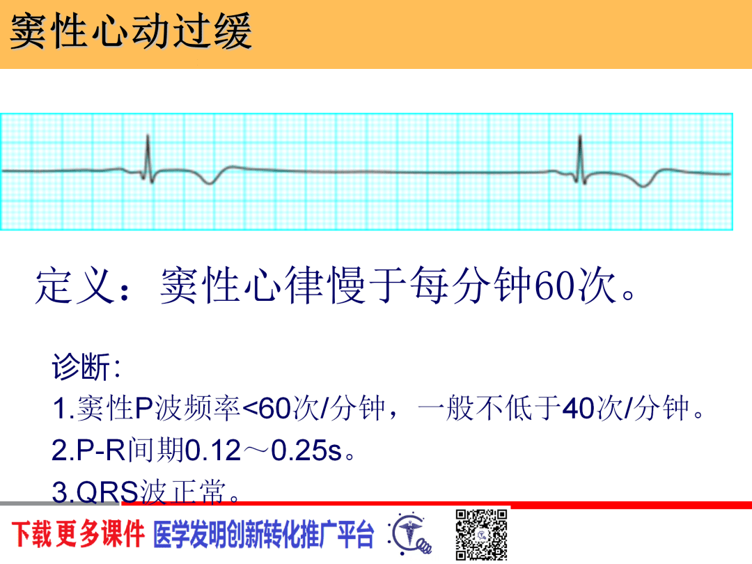 恶性心律失常心电图的识别与处理