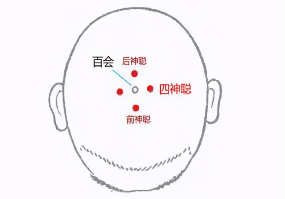 位置:百会在头顶,两耳尖连线的中点处;四神聪位于百会穴前,后,左,右