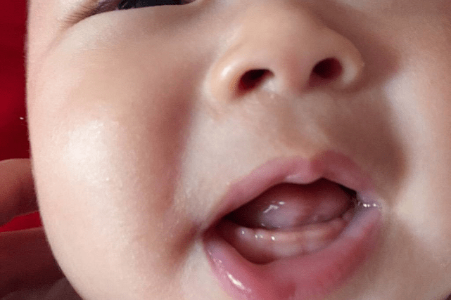 宝宝几个月长牙算正常？出牙信号、应对建议,家长记牢让娃少遭罪