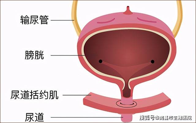 尿潴留:憋尿时,膀胱长时间过度充盈,膀胱壁压力的增大导致控制膀胱