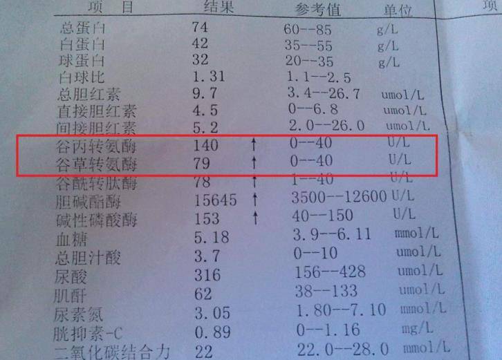 体检报告单中"转氨酶"数值升高,代表着什么?听听医生怎么说