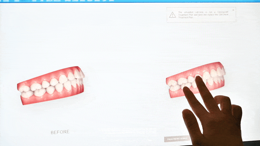 啦~ 为了方便后续定制详细的矫正方案,花生穿上了防辐射服, 拍摄x光