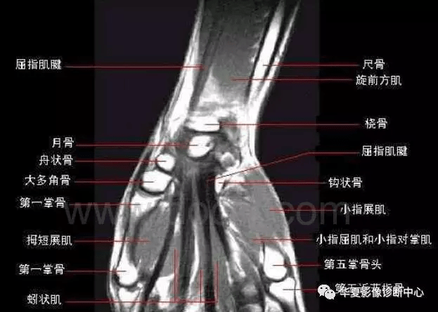 高清腕关节解剖