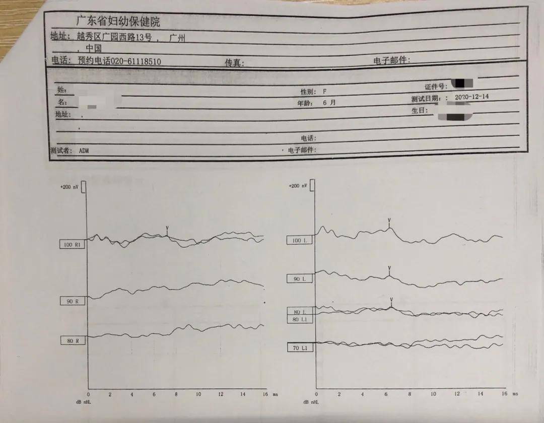 听性脑干反应abr未引出是没有听力吗错