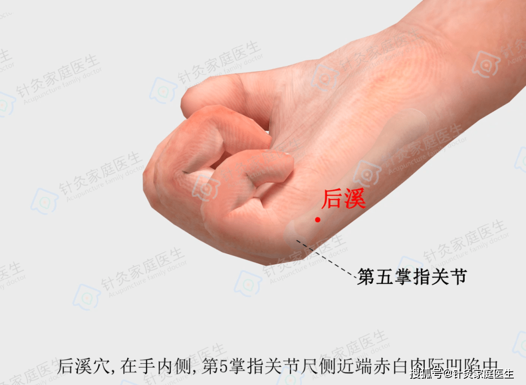 针灸治疗扁桃体炎,眼睛一闭一睁血一出,诶,不痛了!