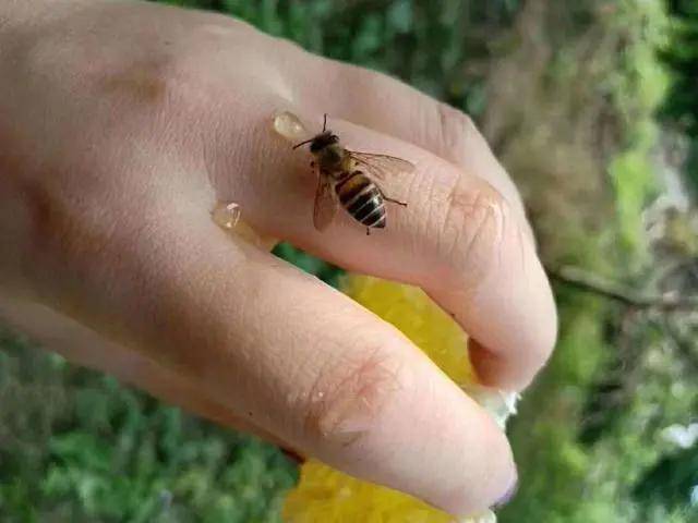 被毒蜂蜇后,身体会出现什么不适症状?