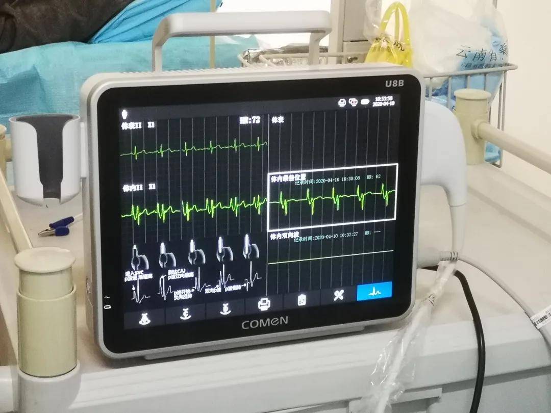 超声影像清晰显示了患者静脉情况,护士选择picc置入处,在科曼u8b超声