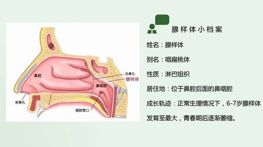 清鼻堂腺样体肥大7宗罪严重影响孩子身体发育和智商