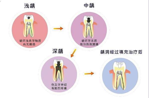 谁说"老掉牙"是一种必然?_牙齿