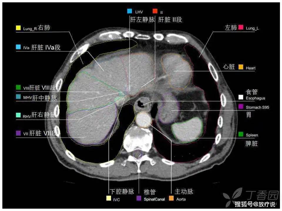 经典高清最实用的上腹部ct影像解剖图谱看过的医生都收藏了