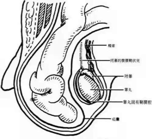 【天使科普】勿以"疝"小而不为,小儿疝气您了解吗?