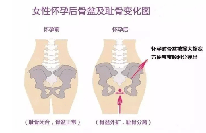 唐艺昕产后修复秘诀来了!快来pick独家技能_骨盆