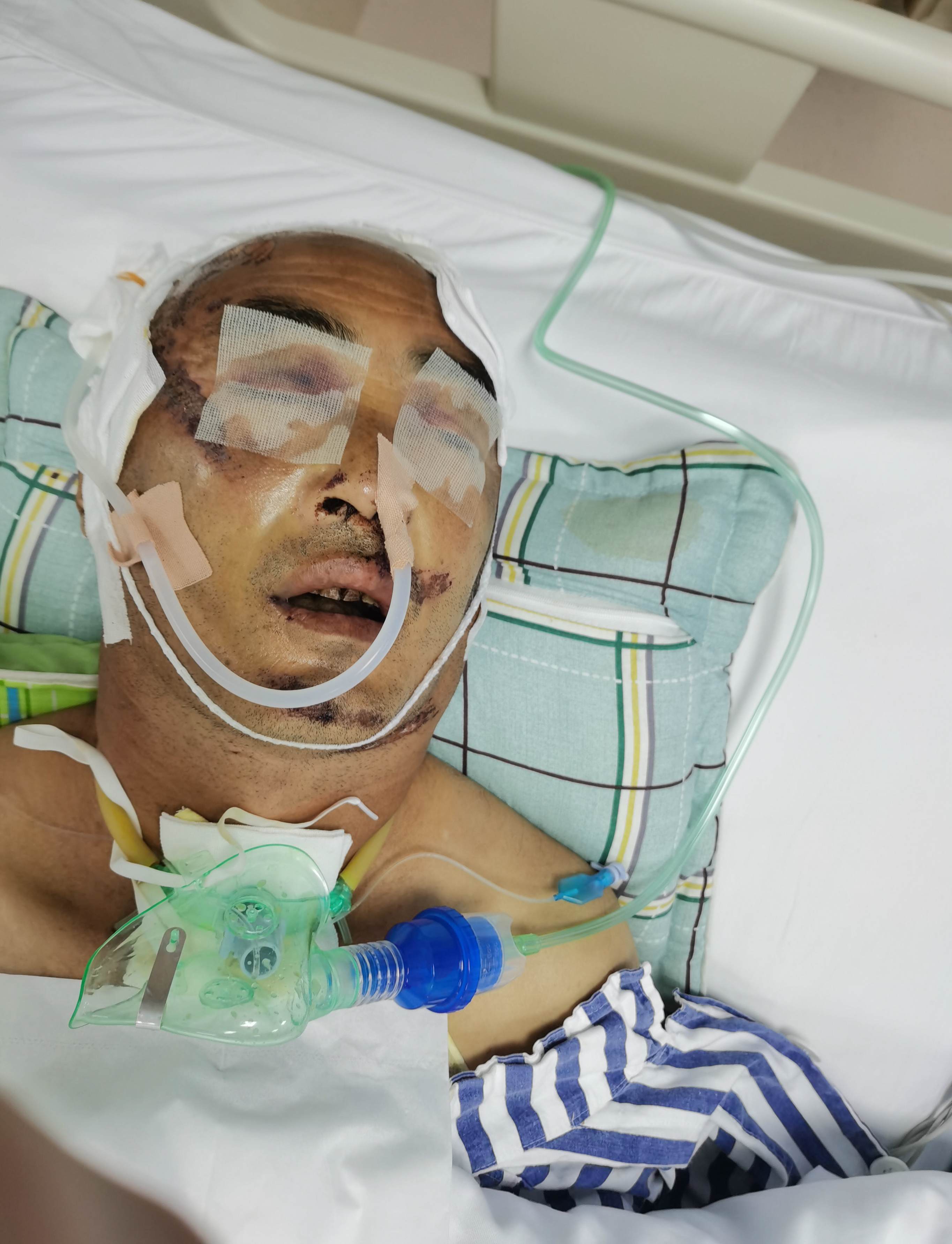 青川县59岁父亲突发意外严重颅脑损伤现在重症病房重点监护急需帮助