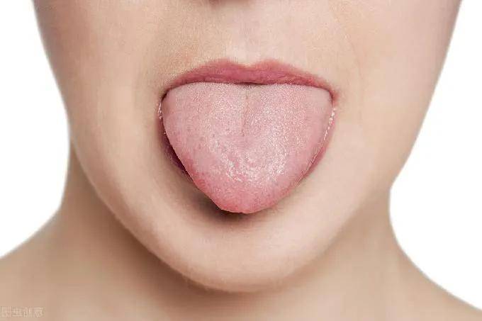 1,表示全身营养不良,使舌头肌肉以及上皮粘膜萎缩 2,常见于慢