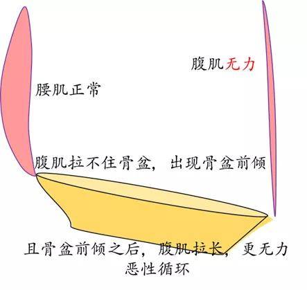 不幸的话因为一个腹肌无力就会出现诸多问题so~好好练腹肌很重要重要