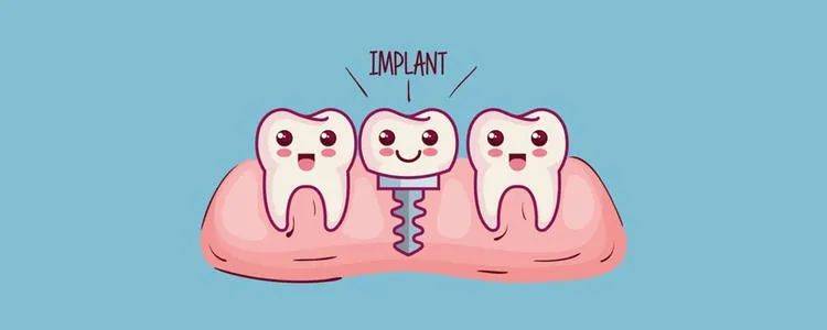 牙种植专家表示:别想太多,种牙前你要知道这些事儿