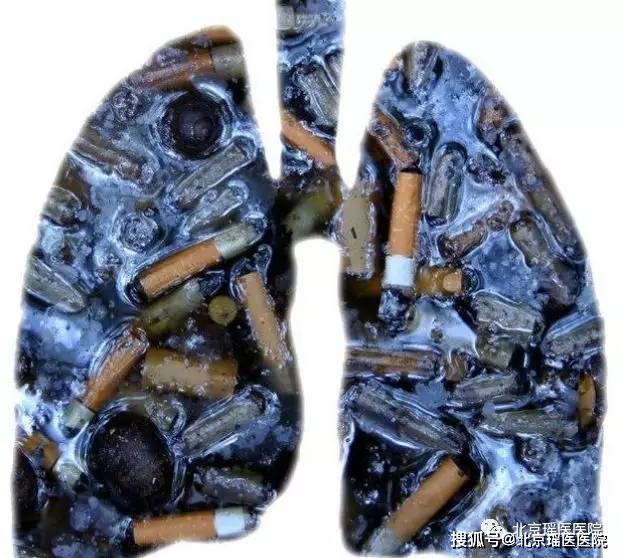 【关注】抽烟多久肺会变黑? 当出现这些征兆时,说明你