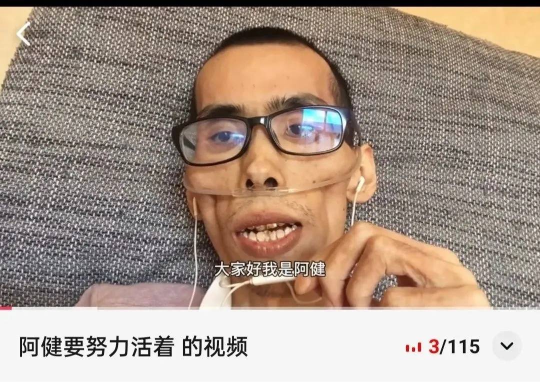 "抗癌网红"阿健因肠癌复发去世!抗癌一年多几乎成骷髅人._筛查