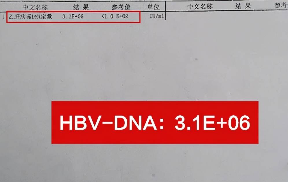 肝病专家潘运华:忽视乙肝病毒,26岁小伙病情恶化成大三阳