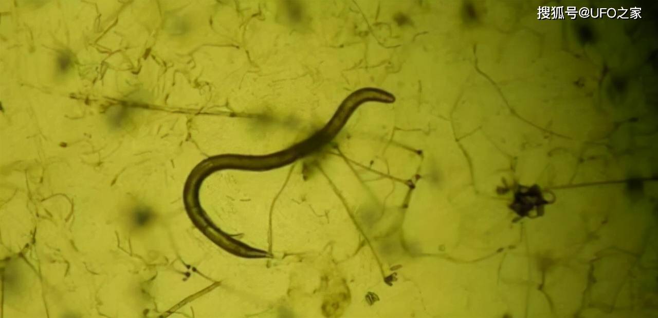 刚地弓形虫,又简称为弓形虫,被科学家们誉为最"成功"的寄生虫之一