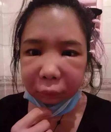 吸烟者,身上这2个地方"变粗",是肺给你的信号—戒烟!