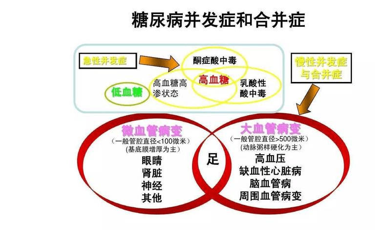 得了糖尿病怎能只看血糖专家提醒小心并发症