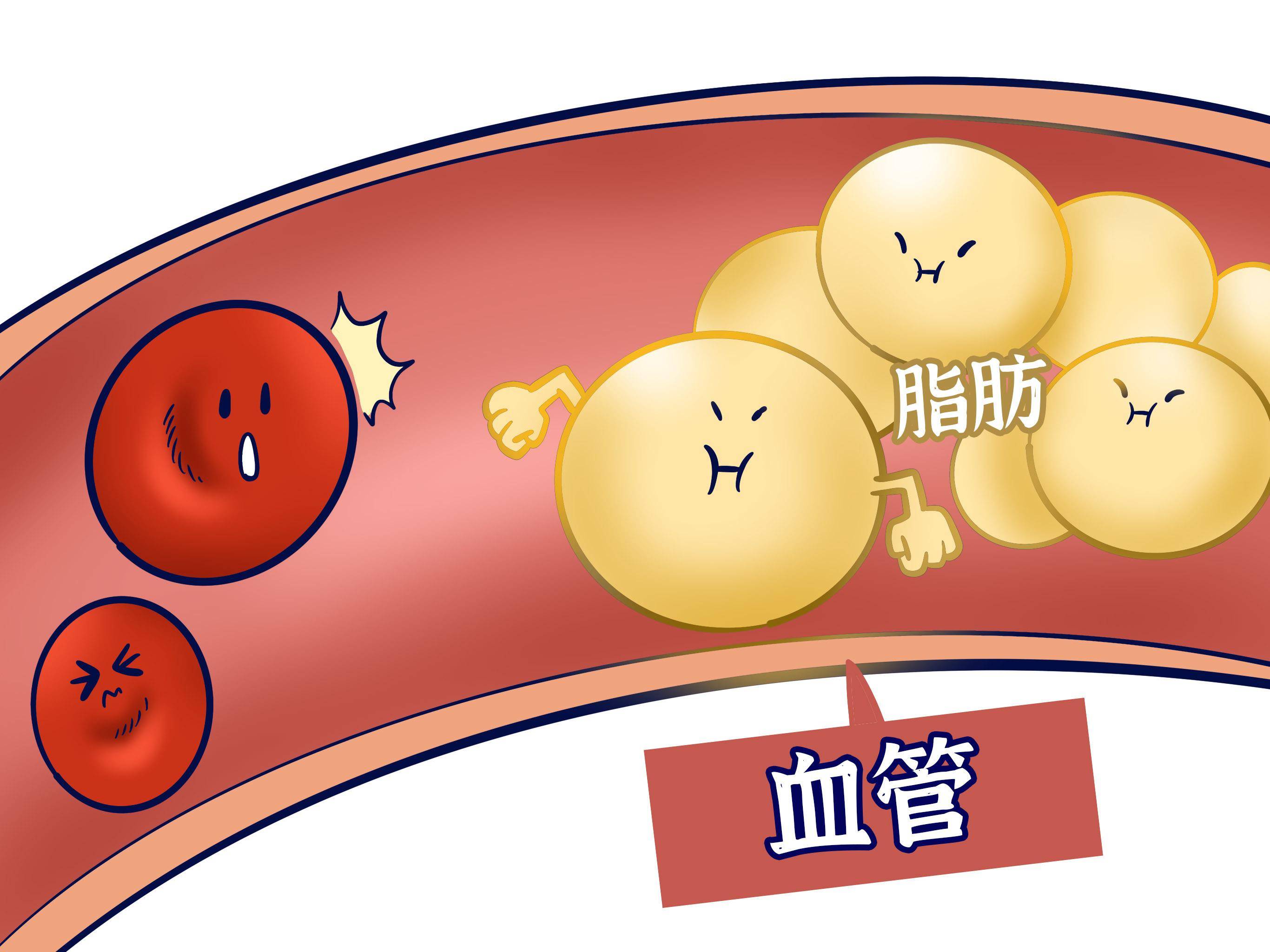 高血脂可分为哪几种类型?甘油三酯高,胆固醇正常应该怎么办?