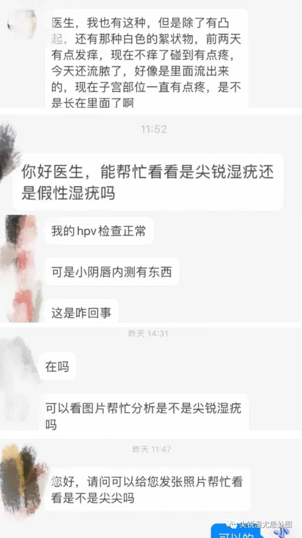 我来告诉你到底怎么分辨尖锐湿疣和假性湿疣这两个小妖精!