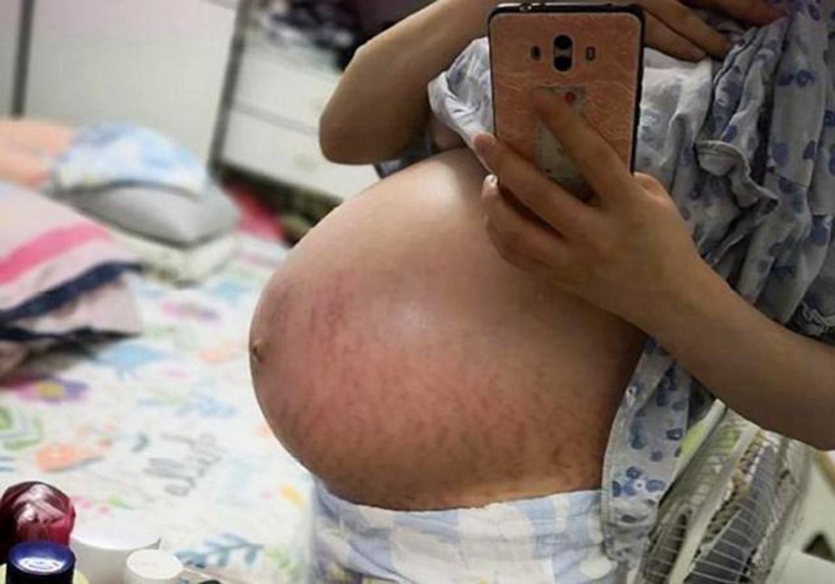 孕妇的肚型暗示生男生女？别被懵了,孕肚上怀和下怀二者区别在此