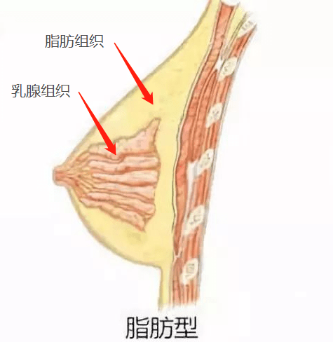 脂肪型胸型在了解减肥对于胸部大小的影响之前,我们要先了解自己是