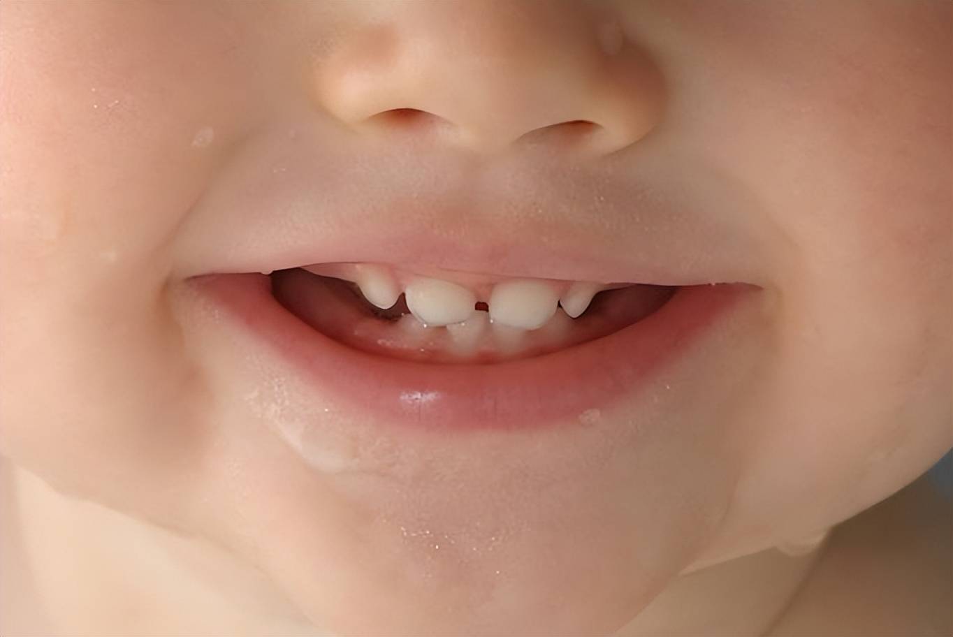 长牙早的娃＂命苦＂？乳牙可能会陪伴孩子13年,别忽视它的作用