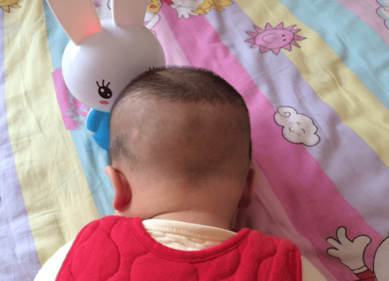 宝宝出生时头发浓密,长大却变成＂小黄毛＂？家长多注意后天因素