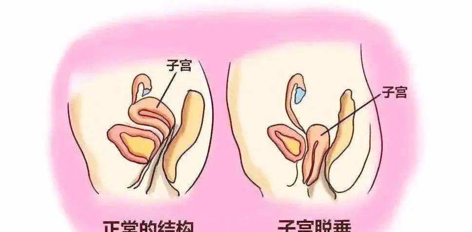 33岁奚梦瑶二胎之后晒瑜伽照火了,网友:这身材怪不