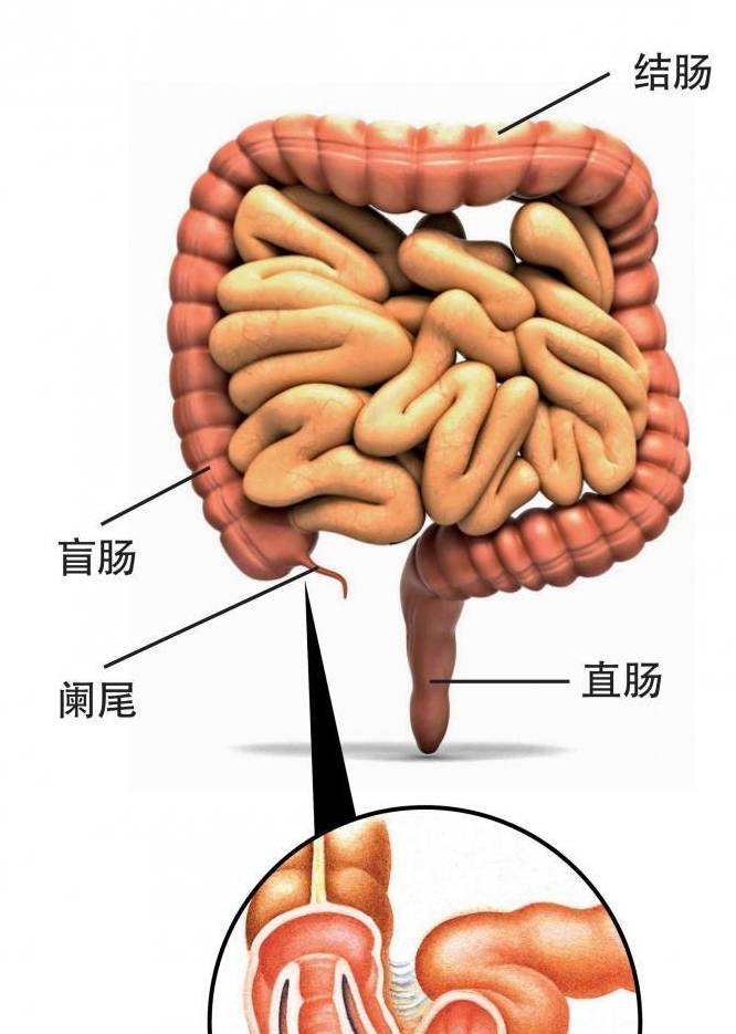 吴彦祖真的是盲肠炎穿孔吗?医生却说不是!这是为什么呢?