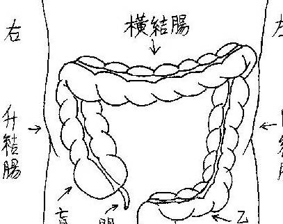便秘老不好,怎么办?_大便_情况_治疗