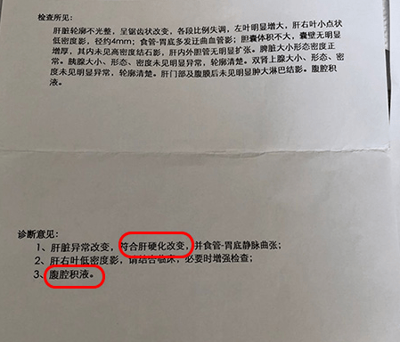 肝硬化导致肝功能丧失,医生说要换肝,看看中医如何治疗的_高密度_形态