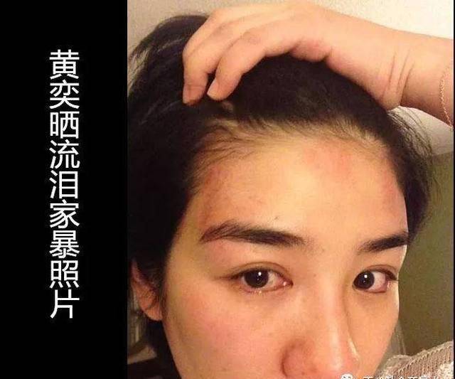 后来黄奕又晒出照片指责黄毅清家暴,两人婚姻亮起红灯.