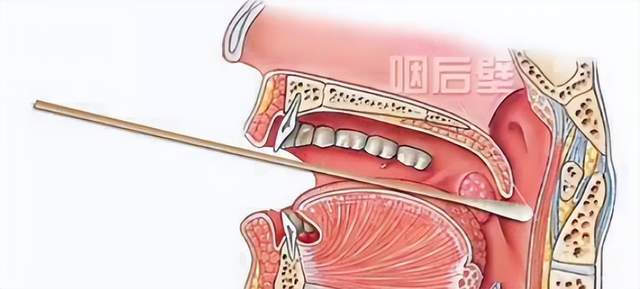 原创天天做核酸检测的你知道自己被捅到长茧的地方是哪里吗