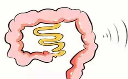 很多肠癌都是拖出来的,因为肠道其实很敏感,稍有不适,就会发出"肠鸣"