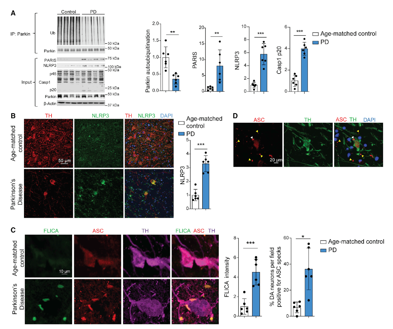 Neuron NLRP3 治疗帕金森病的新靶点 Hopkins parkin 神经元