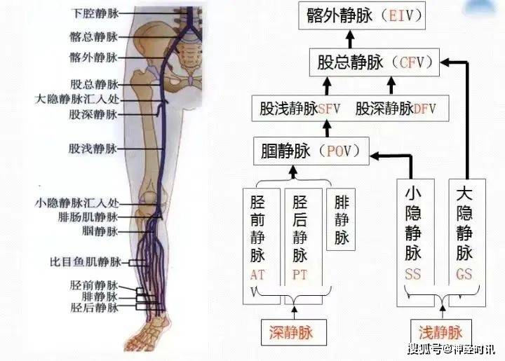 深静脉,浅静脉引流图mcvt 的高发与小腿肌间静脉丛的特殊解剖结构有关