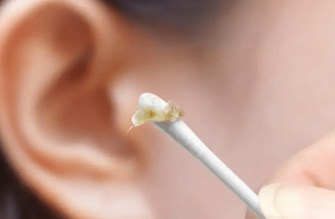 掏耳屎 来自搜狐网