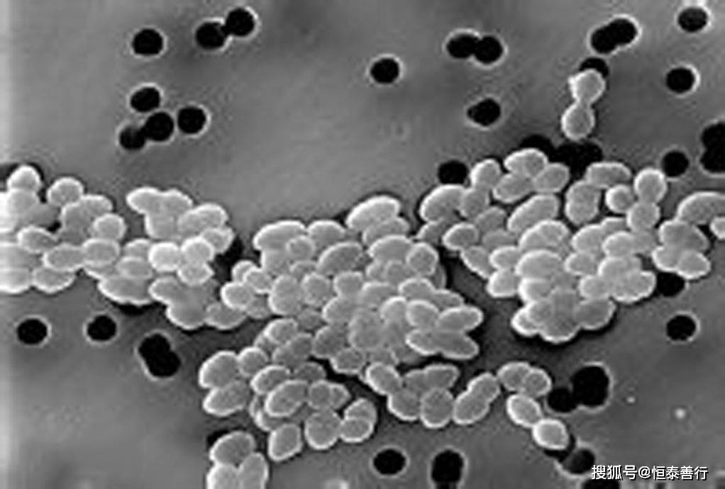 粪球菌属 coprococcus