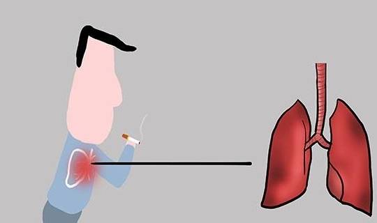 肺癌是什么原因引起的？除了吸烟，还和这4个因素有关！