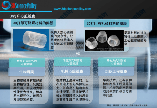 西京病院、唐都病院…案例洞悉心血管医疗范畴的3D打印应用情况