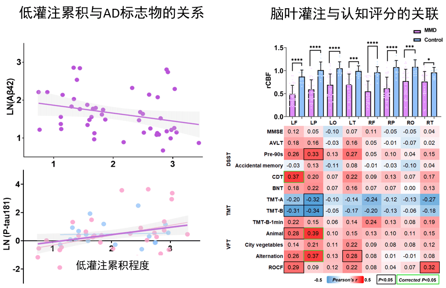 能改善白叟痴呆脑功用！初次证明烟雾病慢性脑低灌注对阿尔兹海默症治疗感化