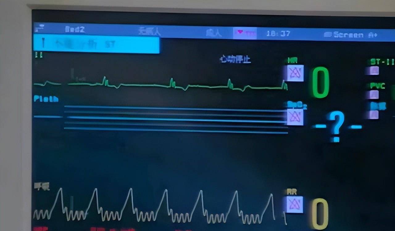 上海65岁白叟心梗病危，儿子全身仅100块钱，出门筹钱竟成永别