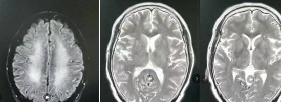 �Լ����没���͹�ע�Թ��������׶������ۺ���ح3���Ӷ�Ƭ ...