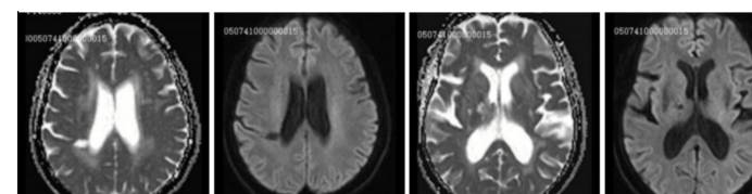 �Լ����没���͹�ע�Թ��������׶������ۺ���ح3���Ӷ�Ƭ ...