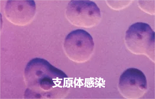 成都试管代妈公司（男性如何判断自己患上了支原体感染）